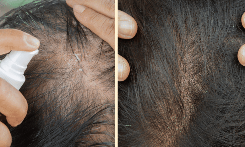 أقوى 10 أنواع زيت شعر مجربة لتكثيف الشعر خلال شهر